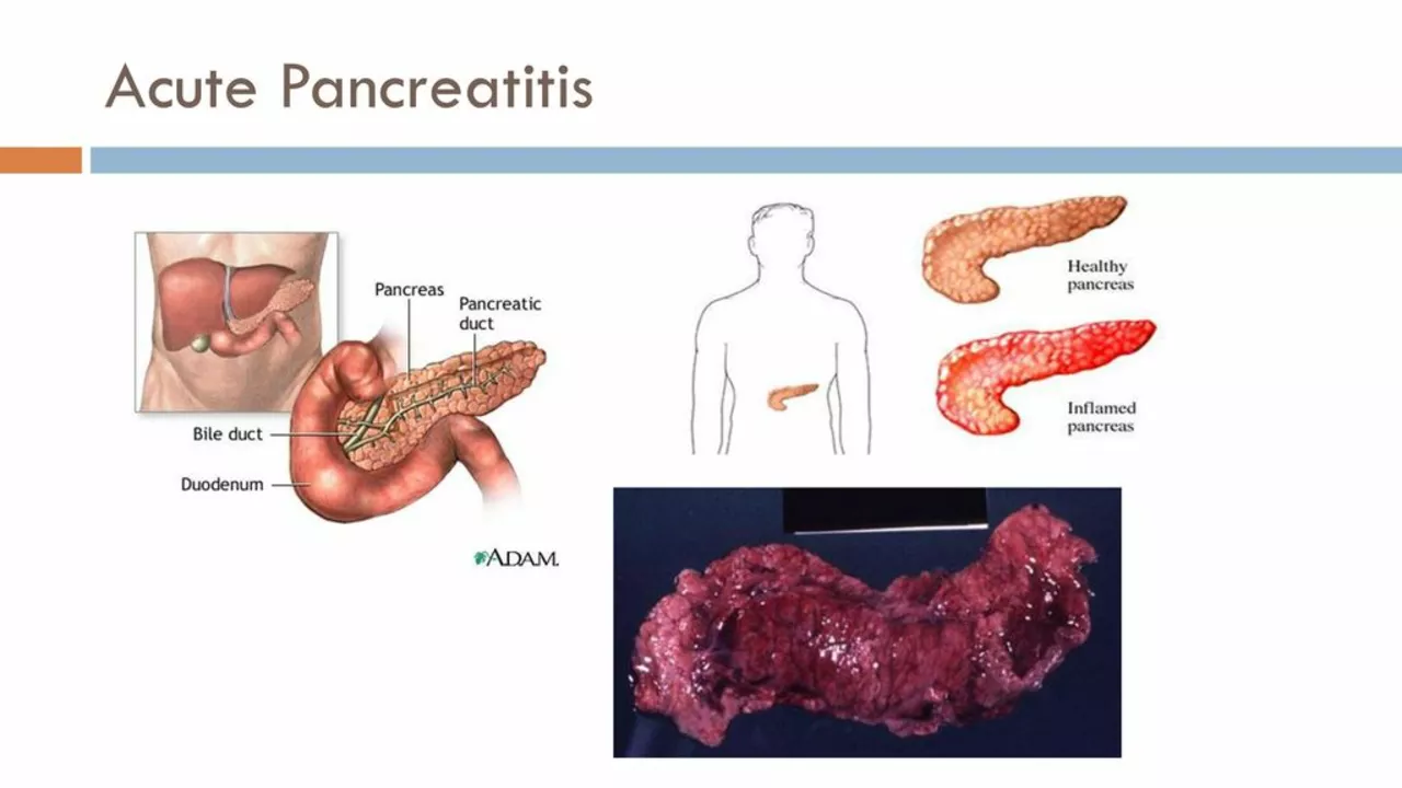 The Connection between Pancreatic Duct Blockage and Autoimmune Diseases